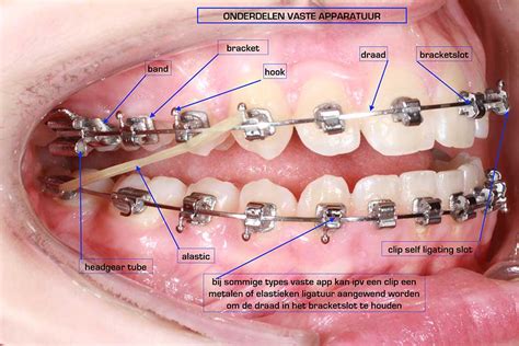 ortho  sleep geert de zutter pagina