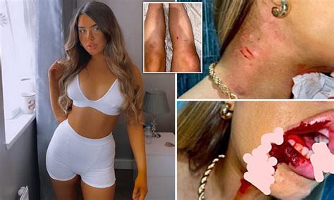 uber passenger 20 claims driver hit her in the face after asking