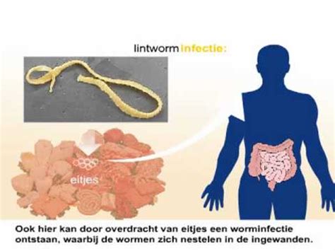 wormen  de menselijke keel symptomen en behandeling wormen en parasieten