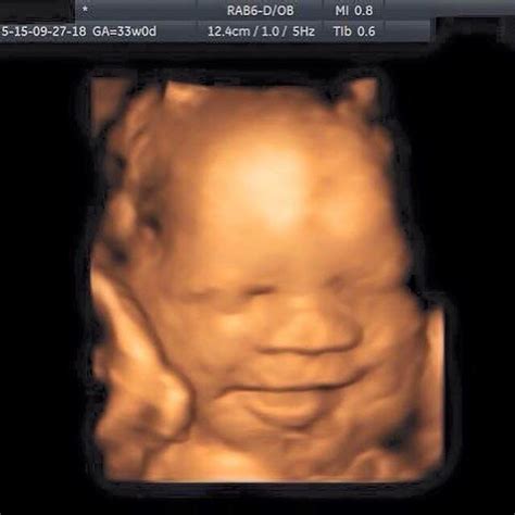 window to the womb в twitter gender scans from 16 3 weeks from £55