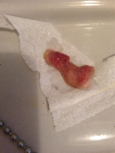 This Beauty Came From The Back Of My Nose As It Hit The