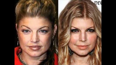 celebrity plastic surgery    pictures youtube