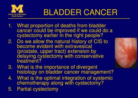 Ppt Bladder Cancer Powerpoint Presentation Free Download Id 4384747