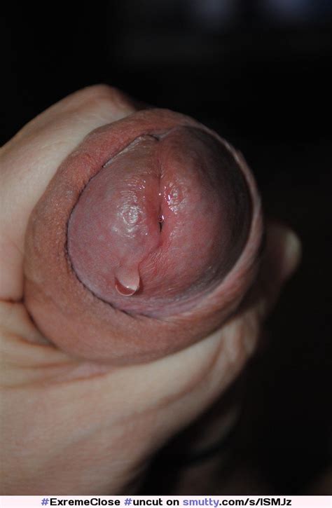 Uncut Foreskin Dewdrop Exremeclose Up An Image By