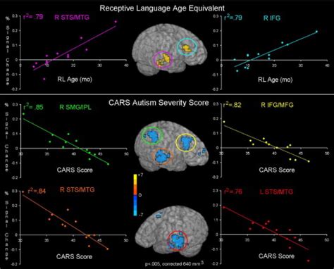 deviant functional magnetic resonance imaging patterns  brain