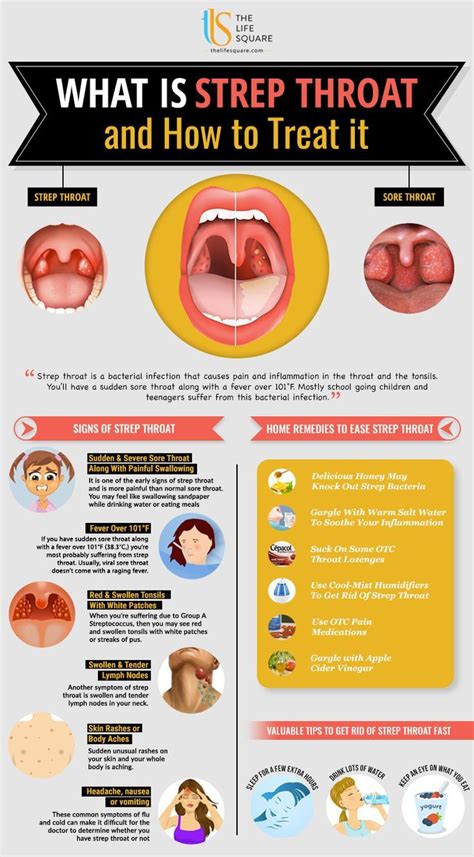 6 warning signs of strep throat ultimate guide Être en bonne santé