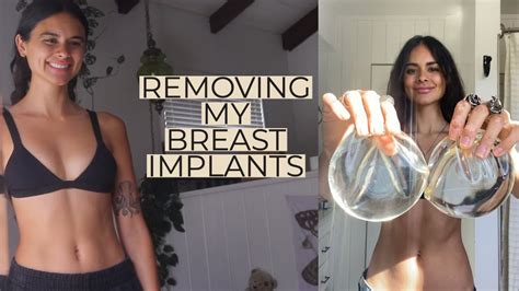 i removed my breast implants full explant story youtube