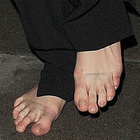 28 worst celebrity feet shockingly ugly and crusty toes