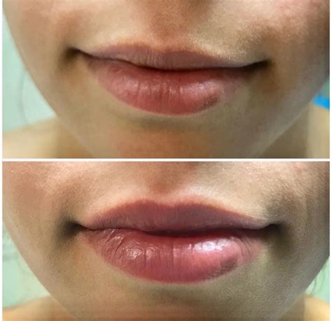 brows lashes lips simply skin laser medispa