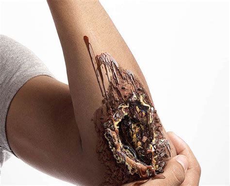 gruesome images show what too much sugar can do to you