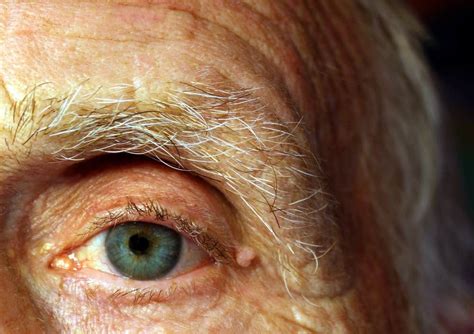 common eye diseases  elderly people gogglesucom