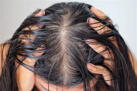 solution  oily hair challenges