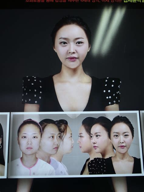 Plastic Surgery Clinic In Seoul Has A Tower Of Patients