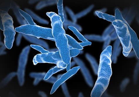 important  recognise tuberculosis tb symptoms early nidirect