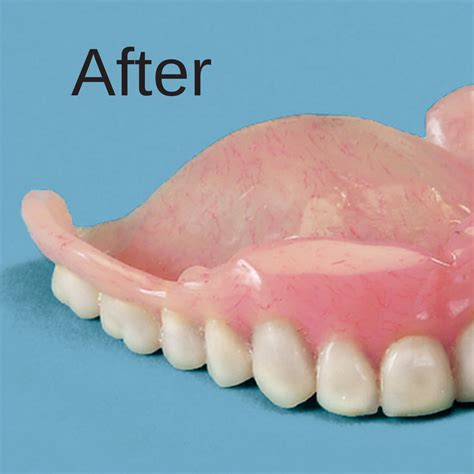 Denture Repair Kit Denture Repair Adhesive Easy Comforts