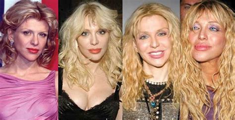 Top 10 Celebrities Who Have Had Plastic Surgery Gone Wrong