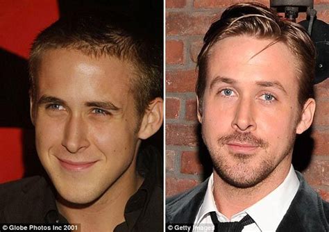 ryan gosling nose job before and after celebrity before and after pinterest