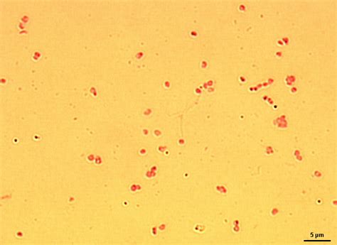 Miniatlas Mikroorganismů