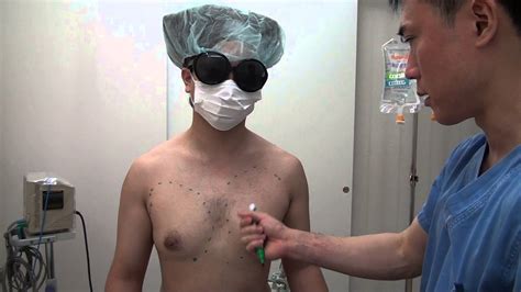 高須クリニック 女性化乳房 手術前のデザイン解説 膨らんだバストを手術で男性的な平らな胸にする 美容整形外科動画 Youtube