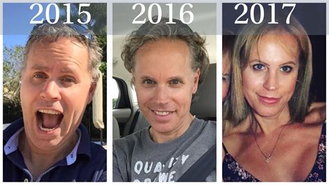 Gender Reassignment Surgery Before And After Photos Male