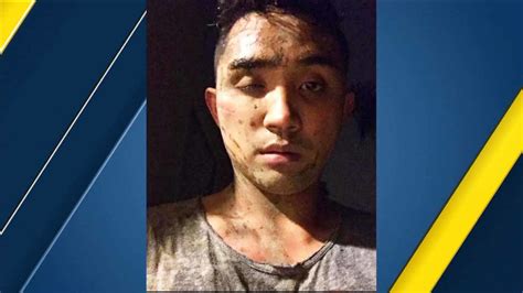 man allegedly attacked in west hollywood over being gay abc7 los angeles