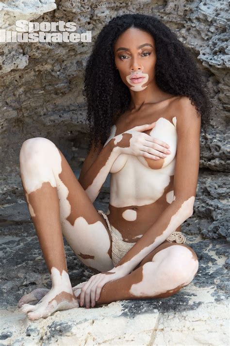 winnie harlow topless thefappening