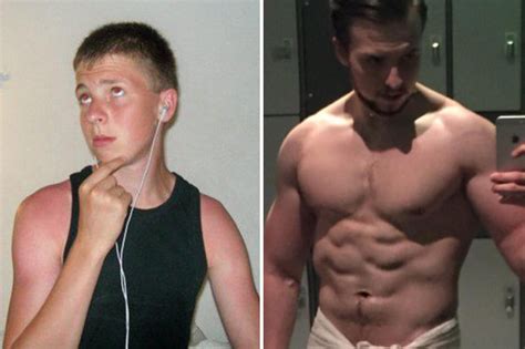 Testosterone Injections Help Man Who Cant Produce Hormone Become Ripped