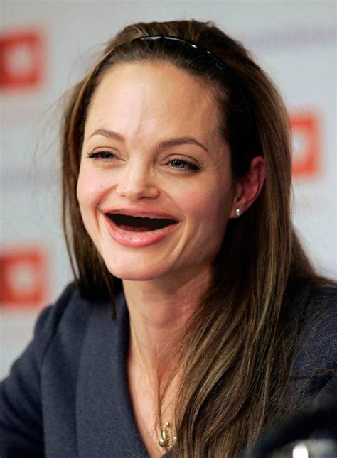 images  celebrities   teeth  pinterest medical
