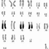 Karyotype Erinaceus Banded Thrace sketch template