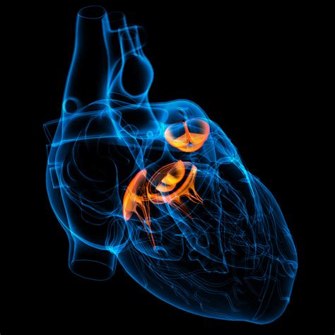 valvular heart disease cardiovascular medical group  southern
