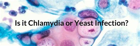 is it chlamydia or yeast infection let s beat vaginal yeast