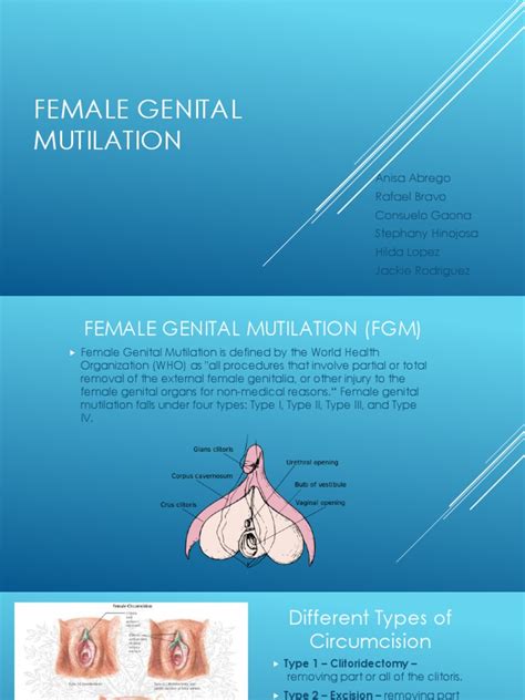 Female Genital Mutilation Female Genital Mutilation