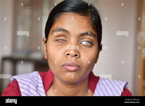 blind girls  res stock photography  images alamy