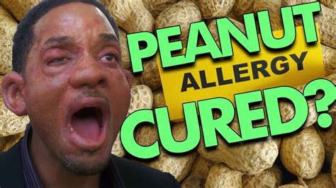 cured  peanut allergy   weeks youtube