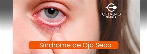 síndrome de ojo seco oftalmoclinic