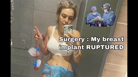 surgery day my breast implant ruptured storytime raw after breast