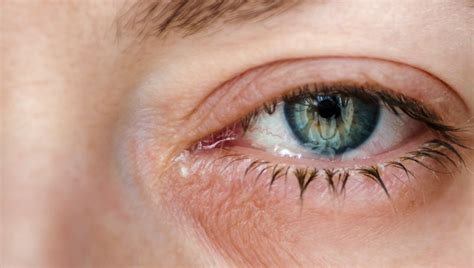macular degeneration treatment eye care  vision loss