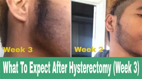 what to expect after hysterectomy week 3 youtube