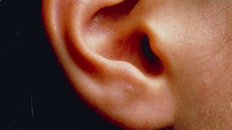 ear disorders linked  hyperactivity bbc news