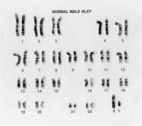 Normal Male 46 Xy Human Karyotype Wellcome Collection