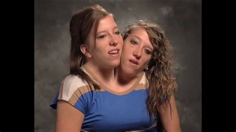 abby and brittany the amazing life of conjoined twins youtube