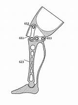Prosthetic Patents Drawing sketch template