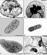 Afbeeldingsresultaten voor "eucheilota Ventricularis". Grootte: 160 x 185. Bron: www.researchgate.net