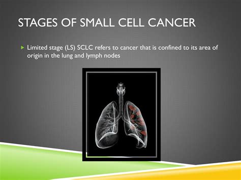 lung cancer powerpoint    id