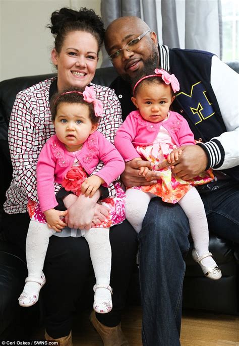 First Identical Twins With Different Skin Colour Born In