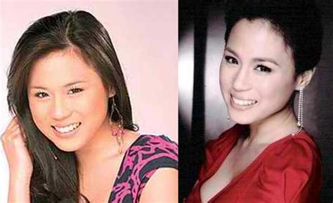 Philippine Actresses That Have Undergone Surgery Gossip