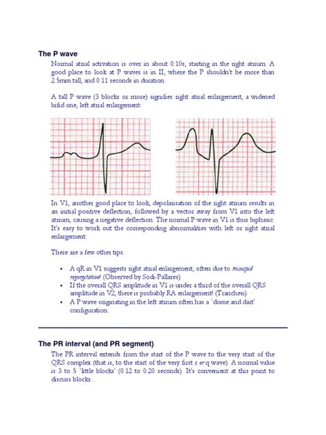 p wave electrocardiography myocardial infarction