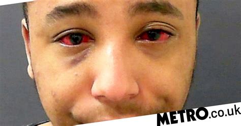 Sex Attacker Told Women Look Into My Eyes I M Going To Kill You In