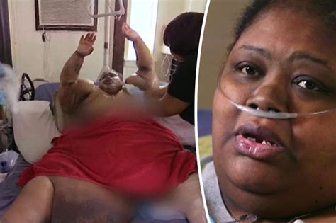Morbidly Obese Woman Who S Weight Rocketed Loses 24st