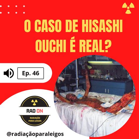 radon  caso de hisashi ouchi  real radiacao  leigos